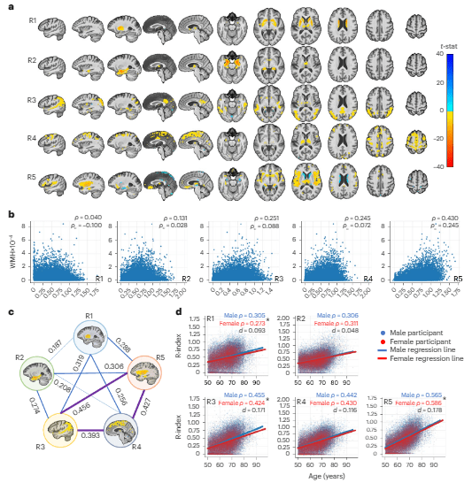 Un estudio identifica cinco formas distintas de envejecer gracias a los datos de casi 50.000 escáneres cerebrales