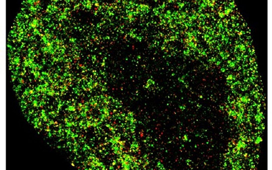 La IA detecta el cáncer y las infecciones virales con precisión a nanoescala
