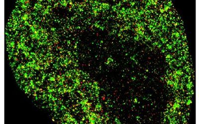 La IA detecta el cáncer y las infecciones virales con precisión a nanoescala