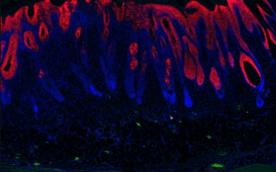La reprogramación parcial dirigida de los estados celulares asociados a la edad mejora los marcadores de salud en modelos de envejecimiento en ratones