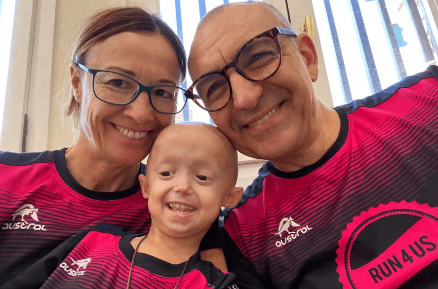 Alexandra, la única niña de España con el síndrome que acelera el envejecimiento