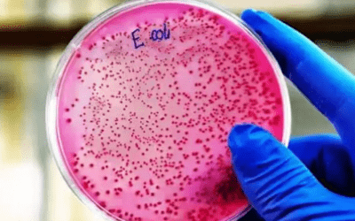 Un posible biomarcador temprano: la colibactina y el cáncer colorrectal en jóvenes