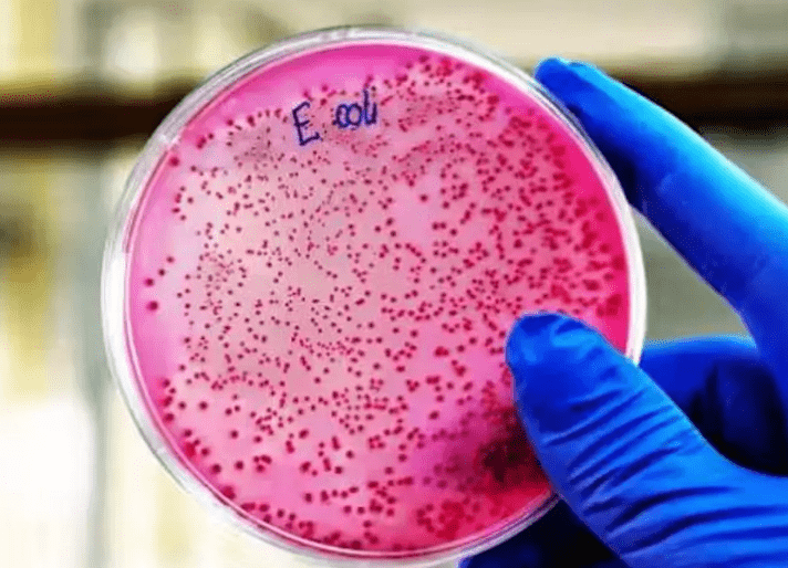 Un posible biomarcador temprano: la colibactina y el cáncer colorrectal en jóvenes