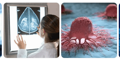 Científicos coreanos desarrollan una tecnología capaz de revertir el cáncer