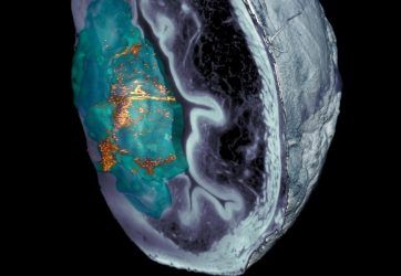 Nanorrobots contra el cáncer: una sola dosis reduce un 90% los tumores de vejiga en ratones