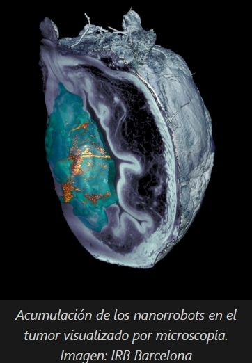 Nanorrobots contra el cáncer: una sola dosis reduce un 90% los tumores de vejiga en ratones